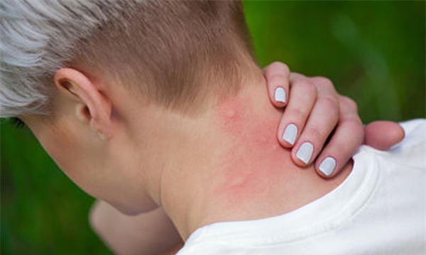 Những người thở gấp và thở mạnh thường là mục tiêu tìm đến của nhiều con muỗi hơn. (Ảnh minh họa)